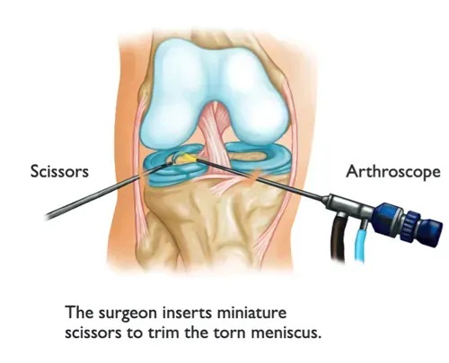 Sports Medicine & Arthroscopy Today, by Dr. Prashath S Gorur