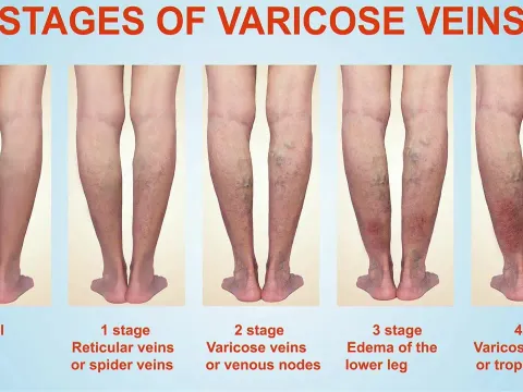 Vascular Surgery