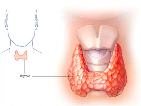 Thyroid care