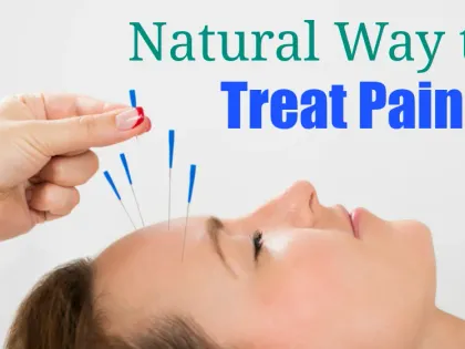 Acupuncture