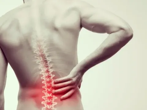 Physiotherapy