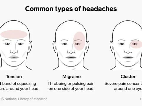 Headaches