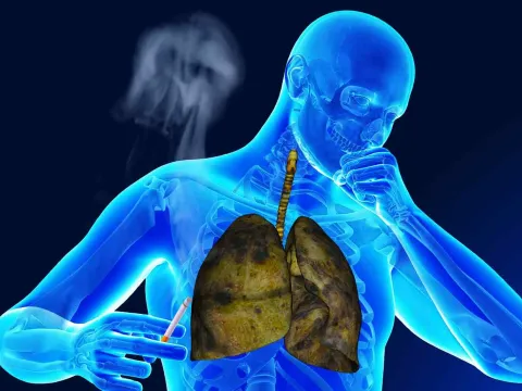 Pulmonology
