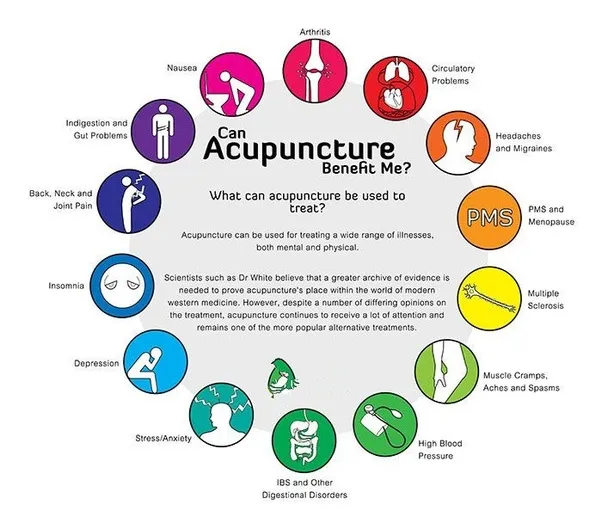 Acupuncture Treatment