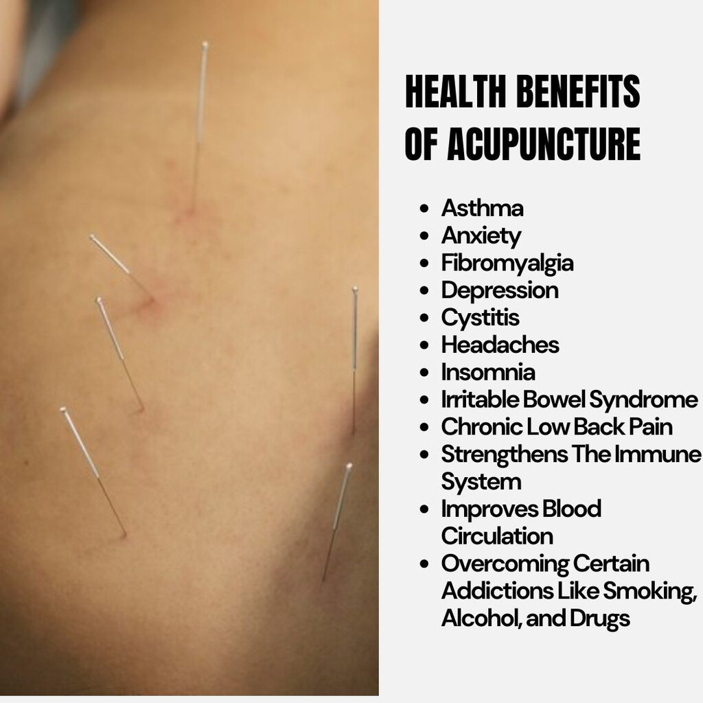 Health Benefits of Acupuncture 1024x1024 1 1